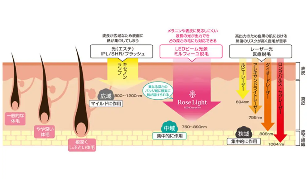 LED脱毛のメカニズム