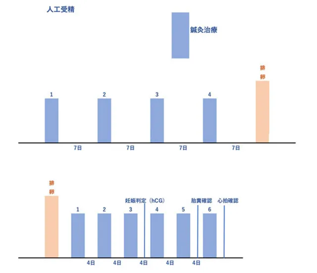 人工授精